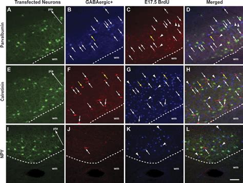 The Effects Of Embryonic Knockdown Of The Candidate Dyslexia