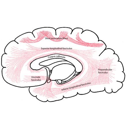 Short association fibers - Gray's anatomy illustration | Radiology Case ...