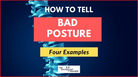 You Probably Have Bad Posture [Here's How to Tell] - The White Coat Trainer