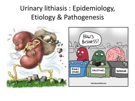 Urolithiasis Ppt