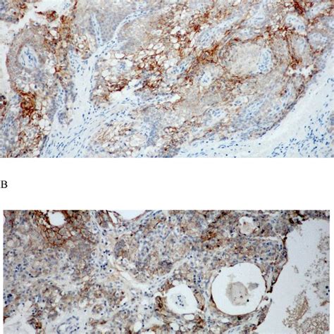 P120 Catenin A And E Cadherin B Expression In Normal Salivary Gland Download Scientific