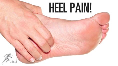 Plantar Fasciitis Heel Pain Causes Signs Symptoms Diagnosis