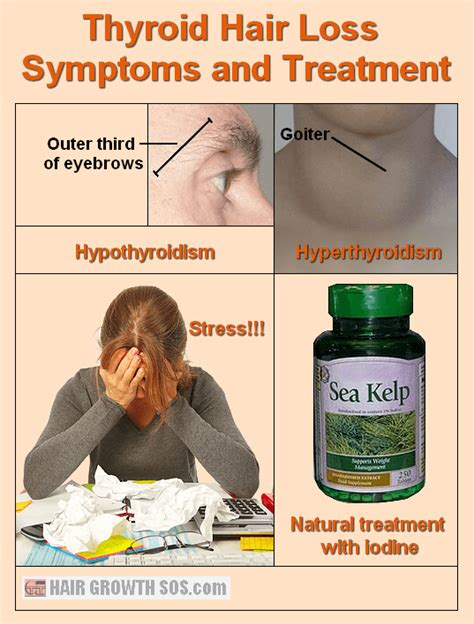 Thyroid Hair Loss Conditions - Symptoms And Treatment Options