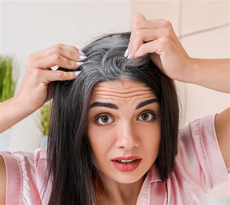 Best Premature Hair Greying Treatment Online Book Free Consultation