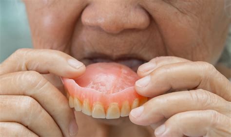 Dental Dentures Vs Implants Making The Right Choice For You