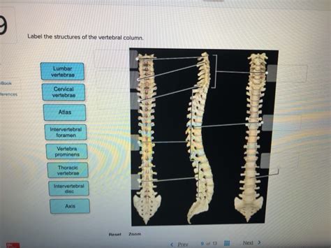 Solved Label The Structures Of The Vertebral Column Lumbar Chegg