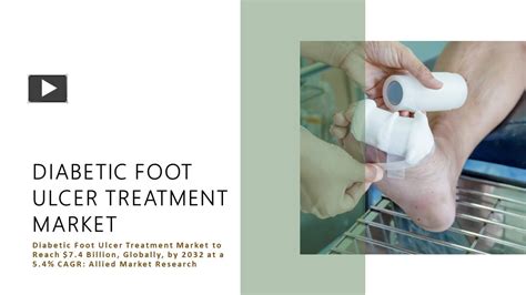 Ppt Diabetic Foot Ulcer Treatment Market Powerpoint Presentation