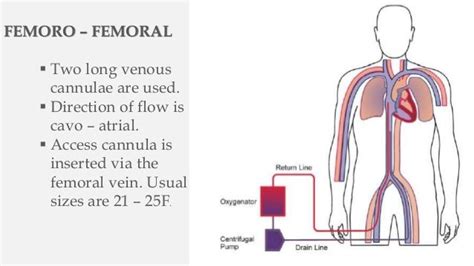 Intra Aortic Balloon Pump And Ecmo