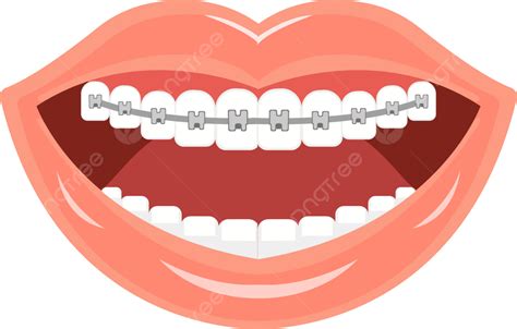 Smile Teeth Braces Clip Art