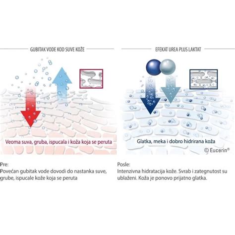 Eucerin Acute Balsam Za Ekstra Suve Usne Ml Eapoteka