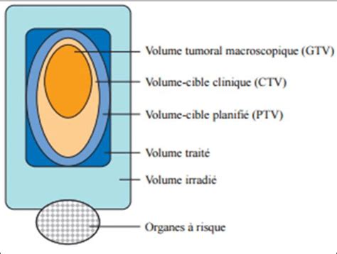 Les Diff Rents Volumes Cibles En Radioth Rapie Edimark Fr