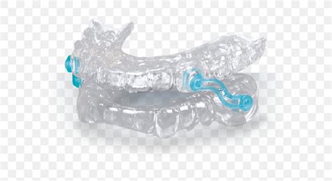 Mandibular Advancement Splint Snoring Sleep Apnea Dentistry, PNG ...