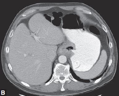 Dr José Efrén on Twitter RT doctordeimagen DIAGNOSTICO MAS