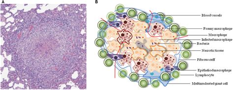 Typical Architecture Of A Tb Granuloma A Representative Granuloma Download Scientific