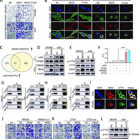 Nek Regulates Gastric Cancer Cell Migration And Cytoskeletal