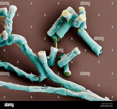 Anthrax Bacteria Coloured Scanning Electron Micrograph Sem Of