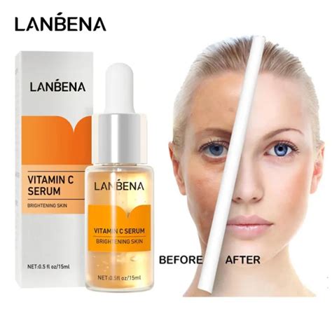 Lanbena Vitamin C Whitening Face Serum Moisturizer Brightening Skin Tone Fade Dark Spot Acne