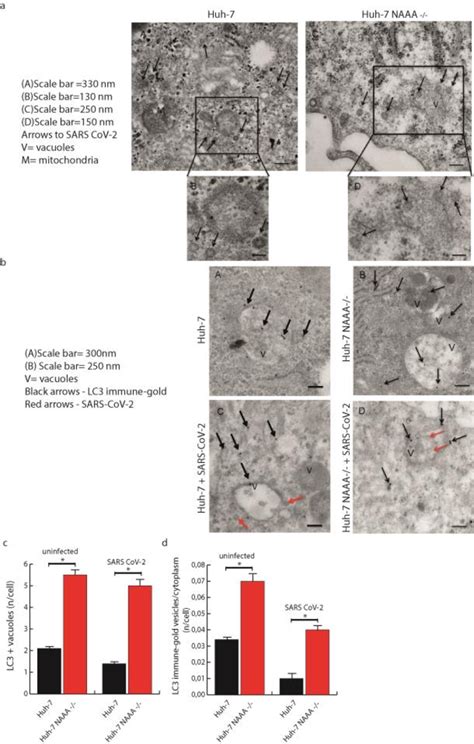 Transmission Electron Microscopy Of Huh 7 And Huh 7 Naaa Infected