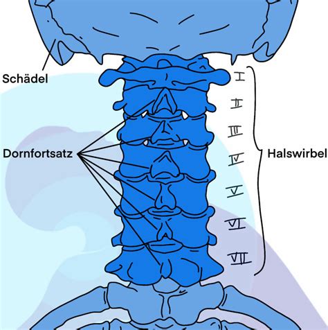 Ursachen für Schmerzen in der Halswirbelsäule Schulter Nacken