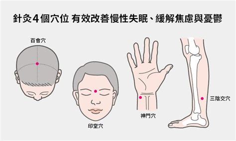 焦慮憂鬱睡不著？研究證實中醫針灸可顯著改善 每日頭條