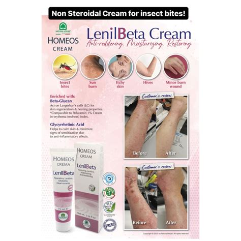 Lenil Beta Cream 75g Non Steroidal For Eczema And Sensitive Skin Shopee Malaysia