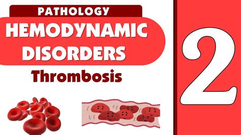 Hemodynamics Lecture Thrombosis Part Youtube