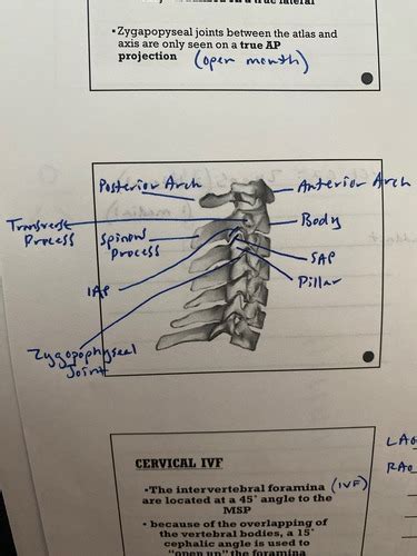 Cervical Thoracic Spine Flashcards Quizlet