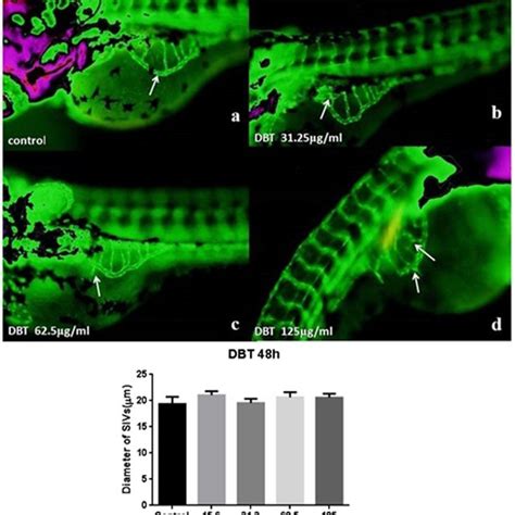 Effects Of Dbt On The Diameters Of Sivs Of Tg Fli Egfp Zebrafish N