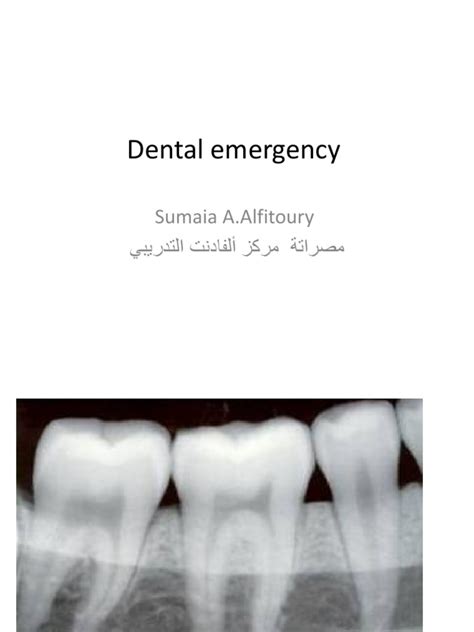 Dental Emergency | PDF | Health Care | Dentistry Branches