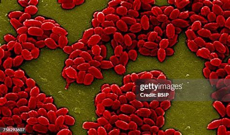 140 Microscopic Image Of Bacillus Anthracis Stock Photos High Res