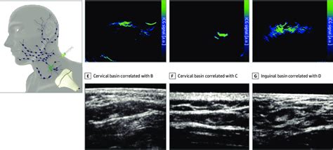 Sentinel Lymph Node Image By Basin Msot Imaging Workflow A Download