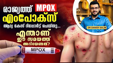 1960 ലകമങങ Mpox ആശങക ആദയതത കസ ഇനതയയൽ Mpox Rapid