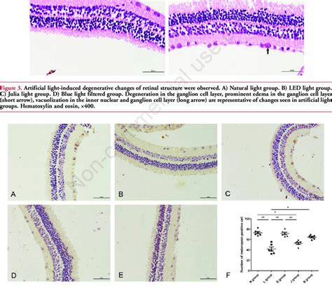 Photomicrographs Showing Melanopsin Immunolabeled Cells In The Retinal