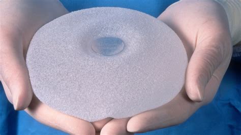 9 Deaths Are Linked to Rare Cancer From Breast Implants - The New York ...