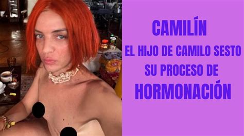 Camil N Hijo De Camilo Sesto Su Proceso De Hormonaci N Youtube