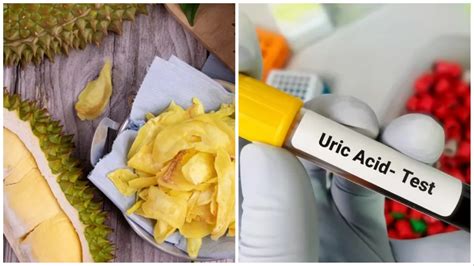 यूरिक एसिड को घटाने के लिए क्या खाना चाहिए What Is The Best Home Remedy For High Uric Acid