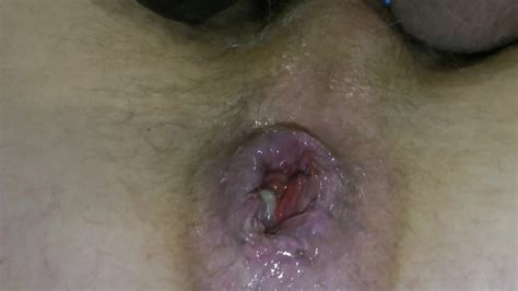 Besoin D Une Bonne Queue Gay Anal Anal Porn XHamster