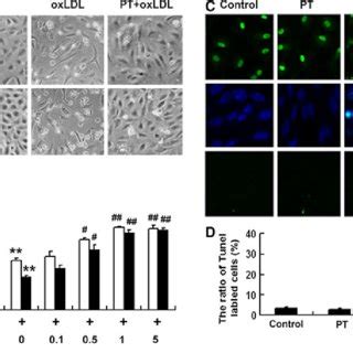 Effect Of Pterostilbene On Oxidized Low Density Lipoprotein