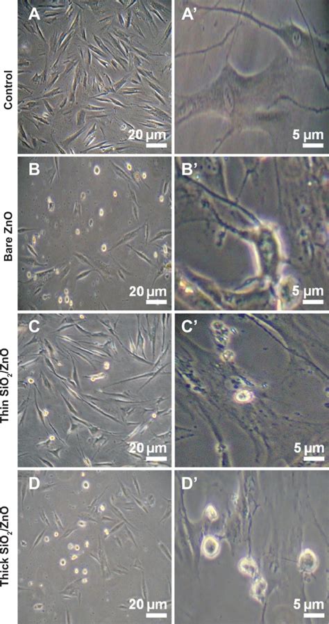 Morphology Of Hdfn Cells Exposed To Nps At 48 Hours Notes Normal 20