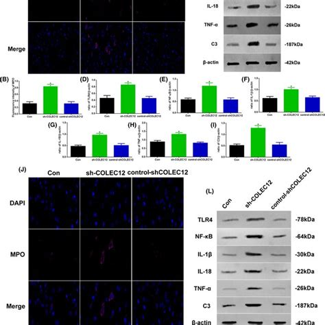 A Western Blot Assay Of Nf‐κb Il‐1β Il‐18 Tnf‐α And C3 Expression