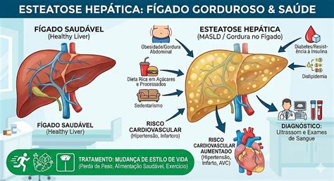 O Que Esteatose Hepatica - Esteatose Hepática: O Que Você Precisa Saber Sobre o Fígado Gorduroso
