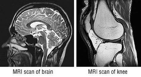 Magnetic Resonance Imaging Mri Harvard Health