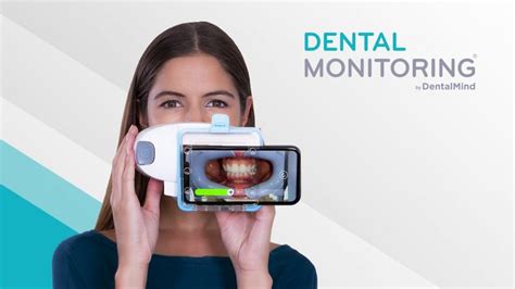 Scanbox Pro Dental Monitoring Reliable Reputation Pinnaxis