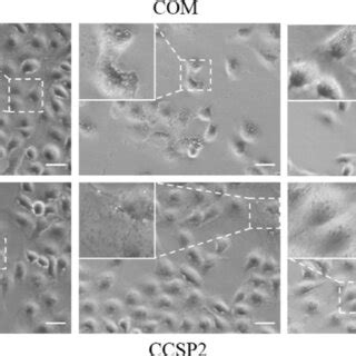 Changes In Cell Morphology Of Hk Cells After The Treatment Of