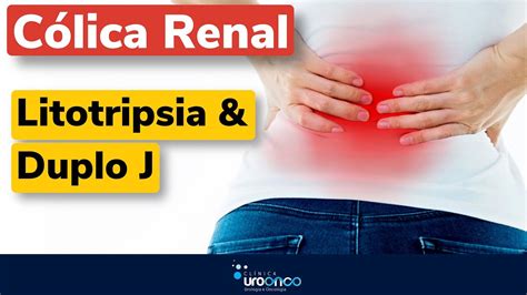 Como é o tratamento da cólica renal cirurgia a laser Litotripsia e