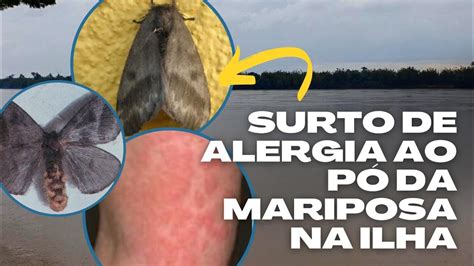 Pó da mariposa causa surto de alergias Porto Alegre Março 2023 YouTube