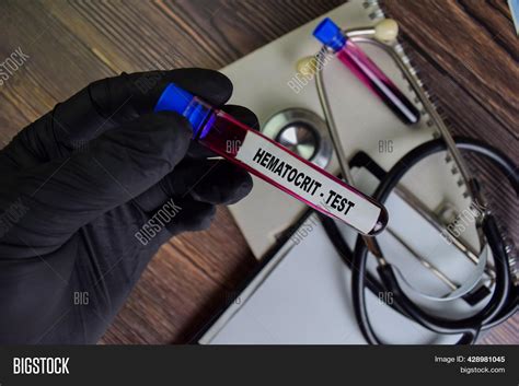 Hematocrit - Test Image & Photo (Free Trial) | Bigstock