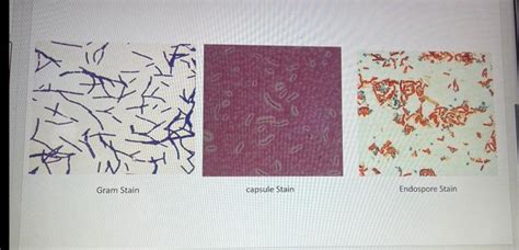 Solved Gram Stain Capsule Stain Endospore Stain Chegg