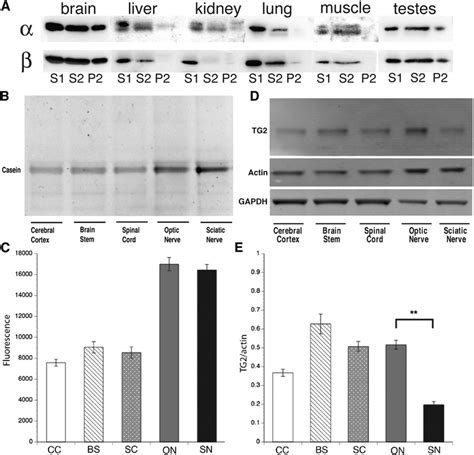 Characterization Of Transglutaminase Activity And Tg2 Protein Levels In