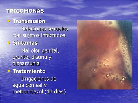 Ppt Enfermedades VenÉreas Parasitarias Powerpoint Presentation Free